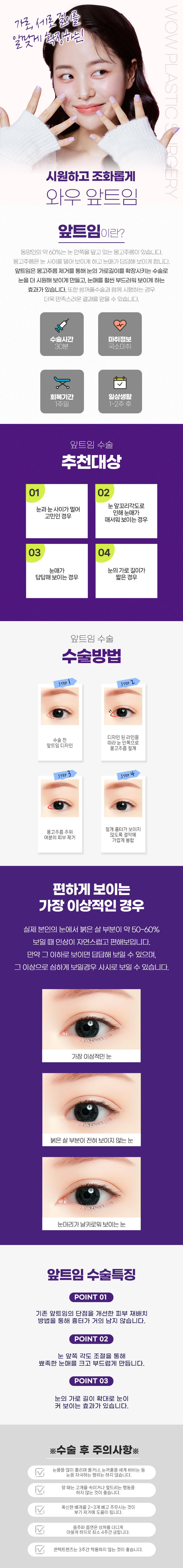 와우성형